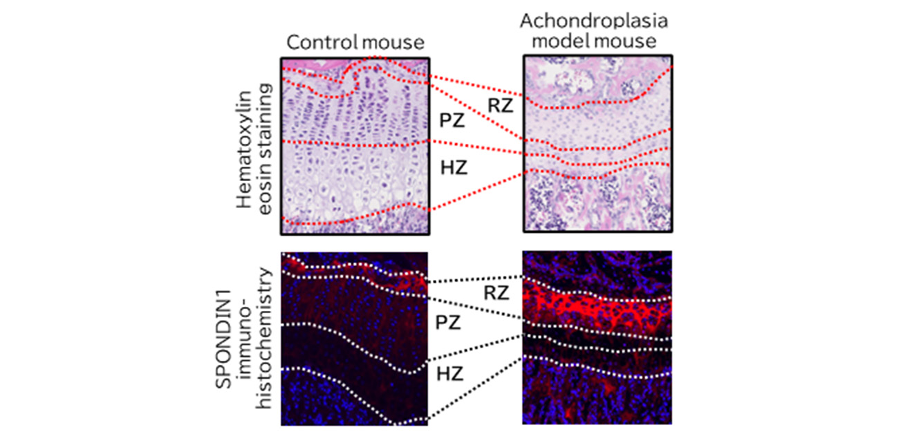 Here we grow: chondrocytes’ behavior reveals novel targets for bone growth disorders