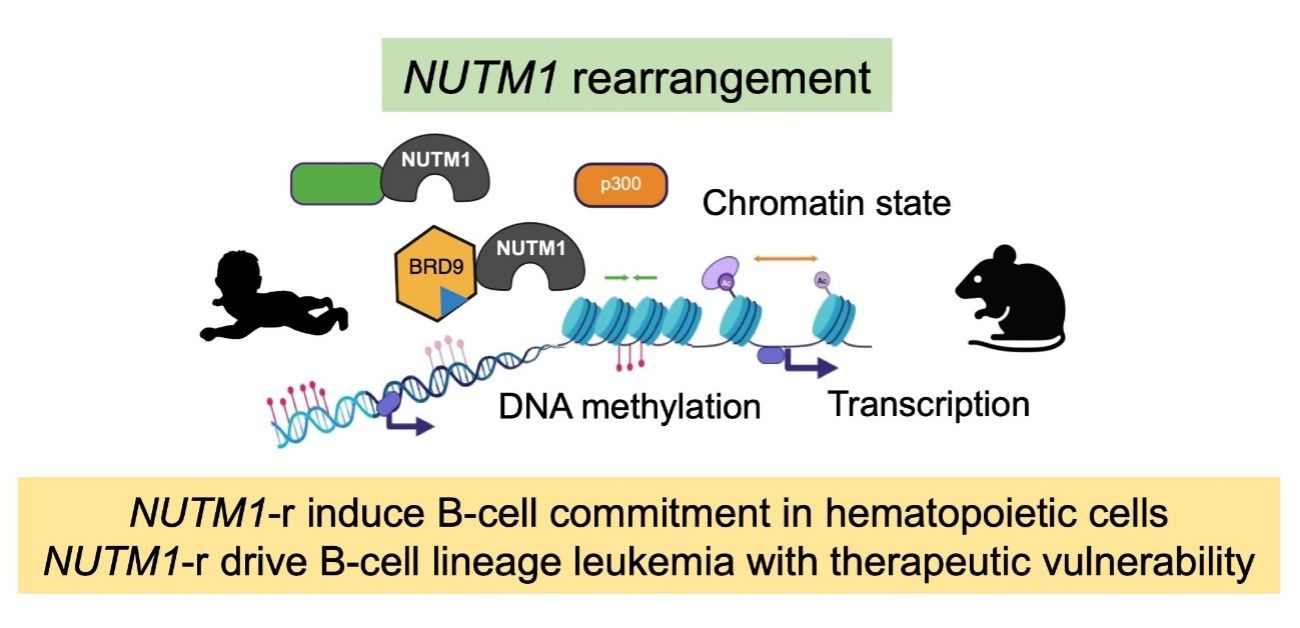 NUTM1 rearrangements cause a highly treatable form of infant leukemia