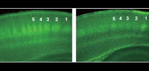 世界初！大麻が脳に悪影響を与えることを科学的に証明 - ResOU