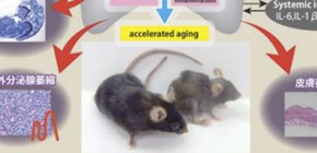21世紀の生活習慣病慢性閉塞性肺疾患の新規モデルマウスに老化現象を発見