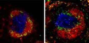 免疫細胞の移動に関わる新たな免疫制御因子COMMD3/8複合体の発見