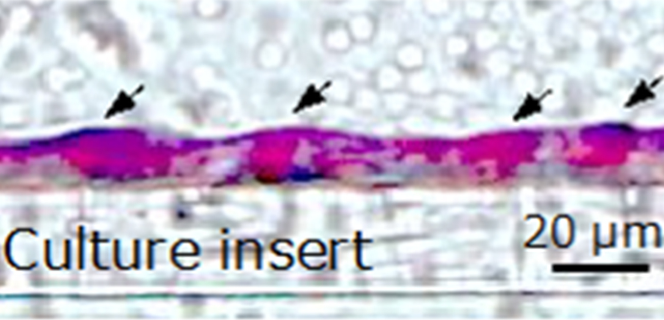 iPS細胞から結膜上皮の作製法を確立