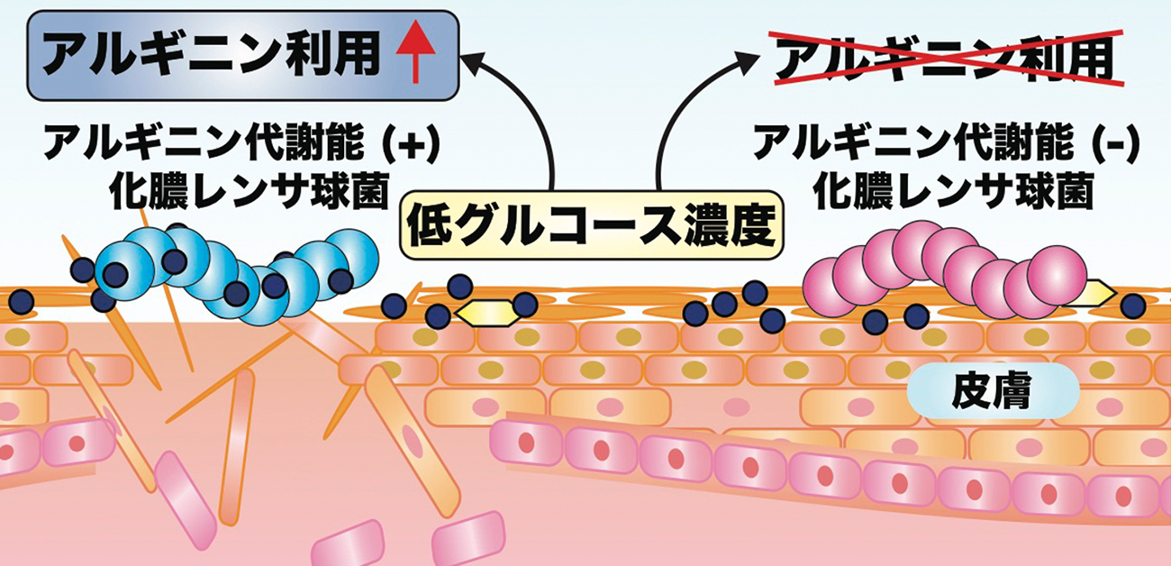 化膿レンサ球菌が皮膚病変の形成に利用する代謝経路を明らかに