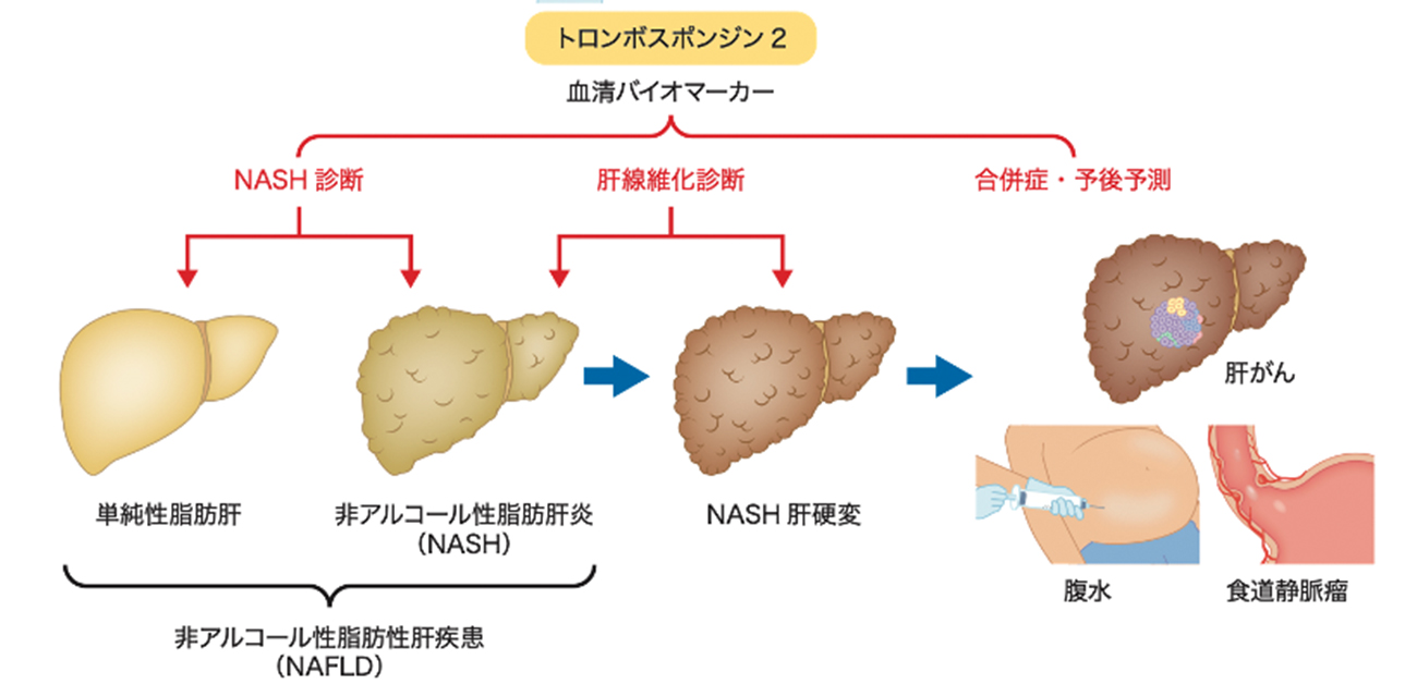 1. 私の肝臓の損傷はどの程度深刻ですか?