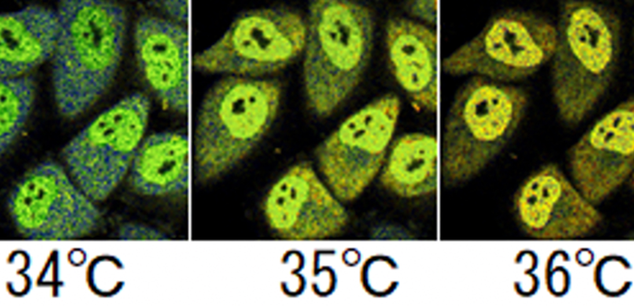 細胞内の温度を0 1 の精度で計測可能な 高感度蛍光タンパク質温度センサーelp Temp リソウ