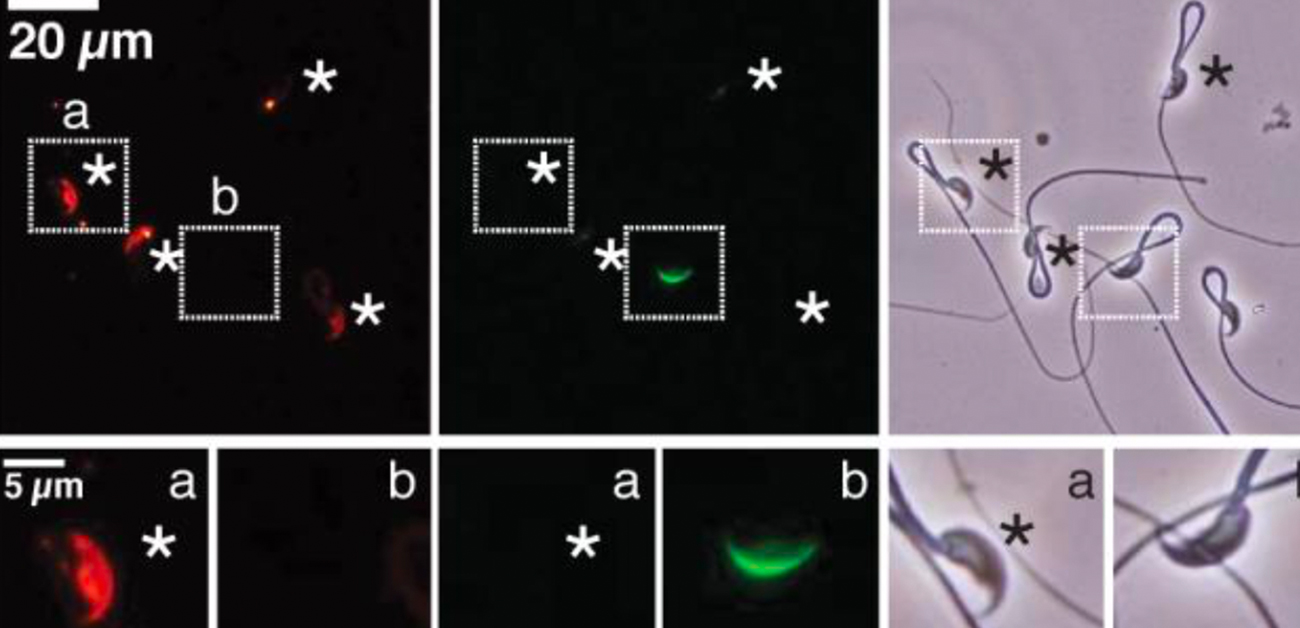 透明帯通過に働く精子膜タンパク質を発見