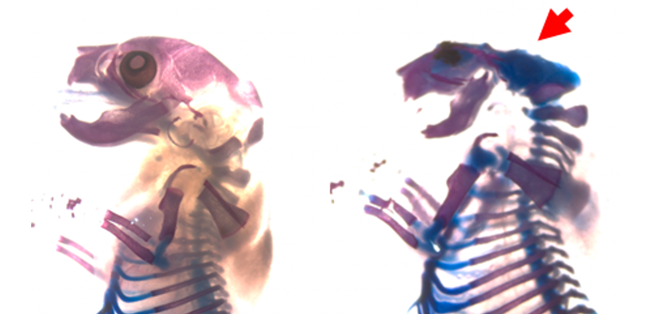 人々は自分が軟骨無形成症の遺伝子を持っていることを知っていますか?