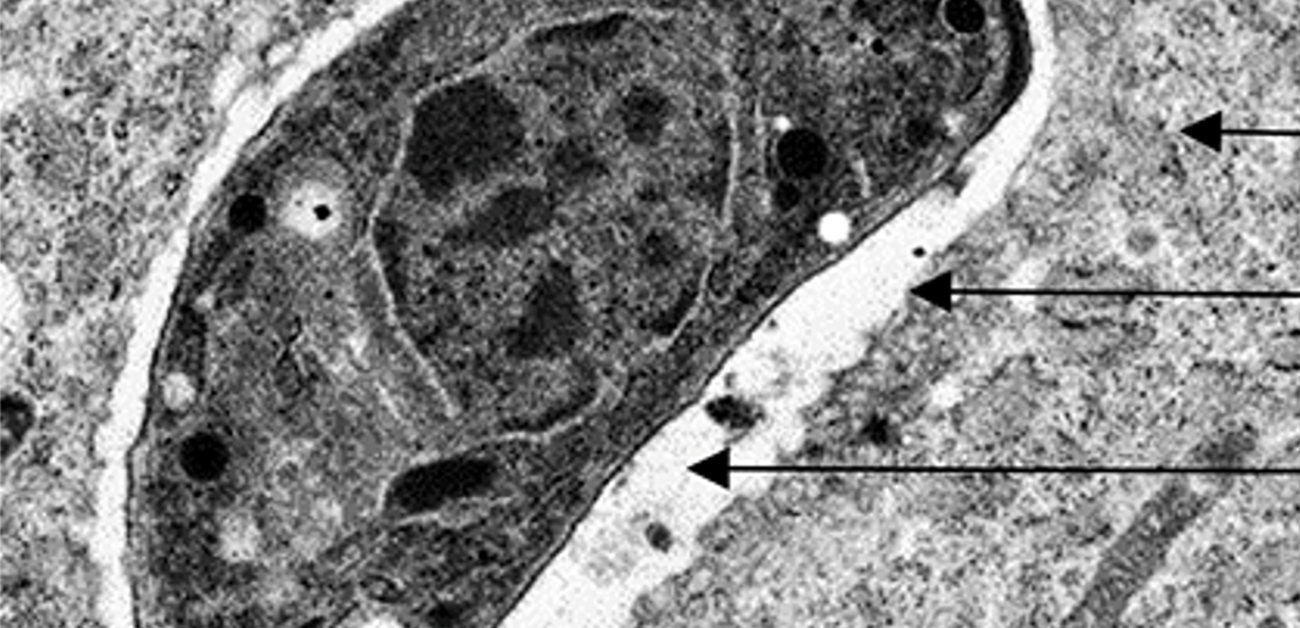生体内の病原性寄生虫トキソプラズマの寄生胞膜を認識する仕組みを解明