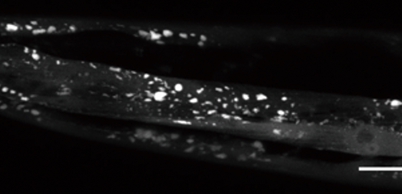 オートファジー分解経路を制御する新たな因子を発見 リソウ