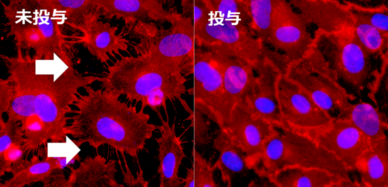 血管透過性を抑制する戦略で病原体を選ばない重症感染症治療薬の開発へ 