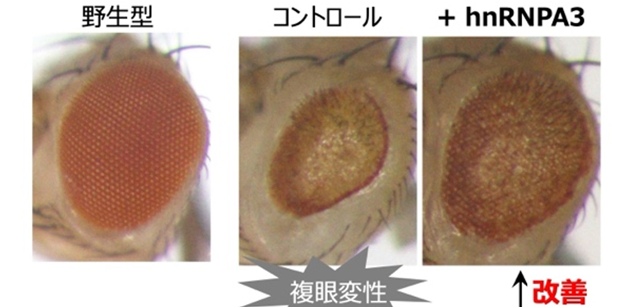 筋萎縮性側索硬化症(ALS)と前頭側頭型認知症(FTD)の根本治療へ