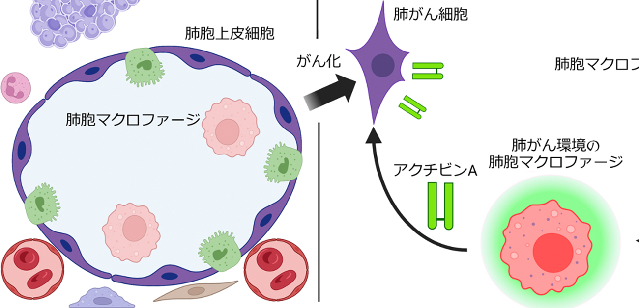 マクロファージは裏切り者！実は肺がんの味方だった