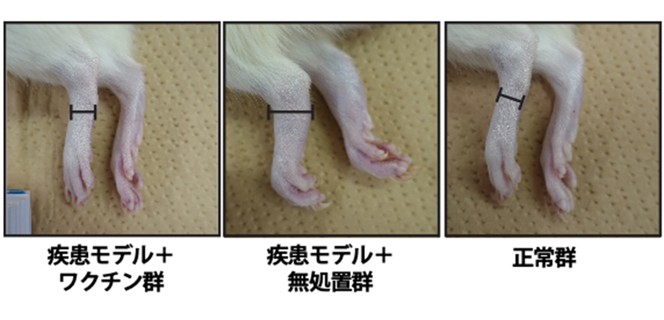 乾癬性関節炎とうまく付き合うための食事、運動、その他のヒント