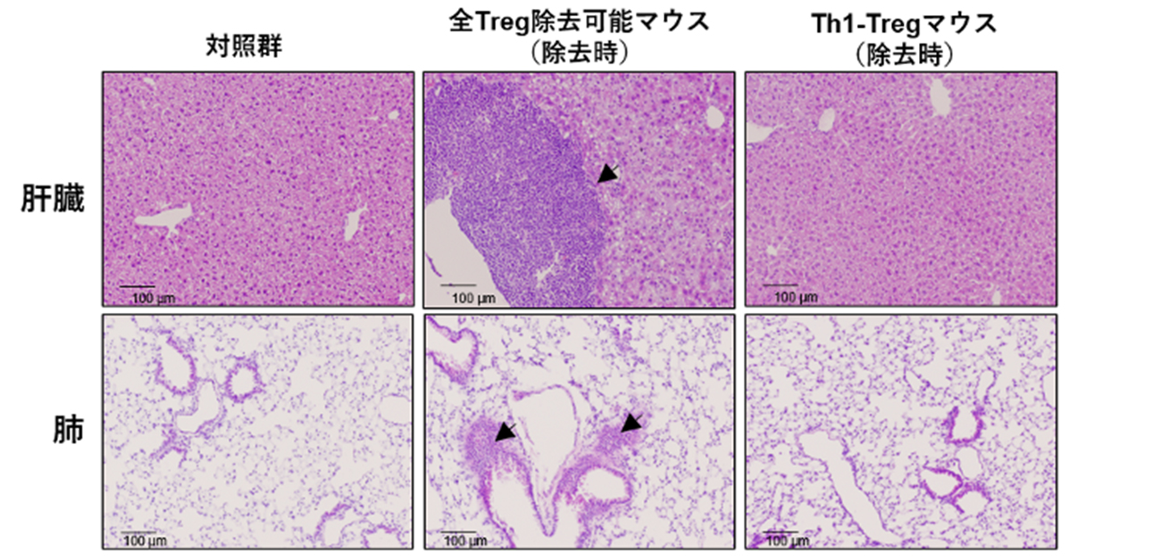 Th1型制御性T細胞の除去は安全にがん免疫を誘導する