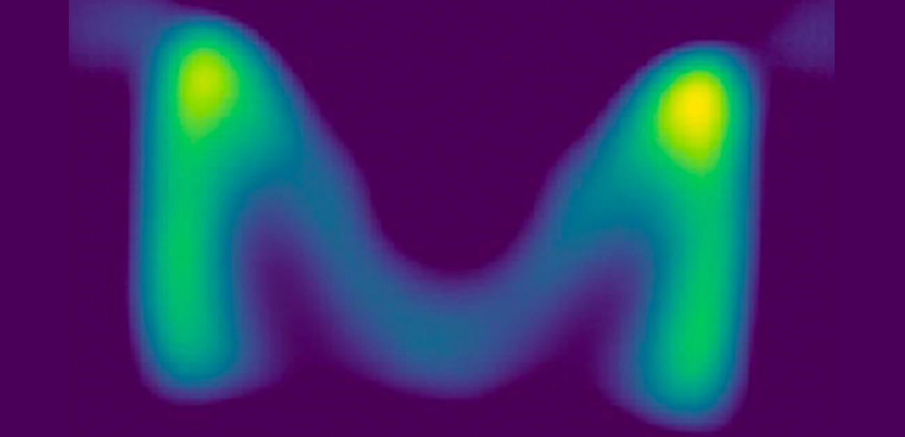 ヒトの脳サイズの撮像が可能な「磁気粒子イメージング装置」を開発