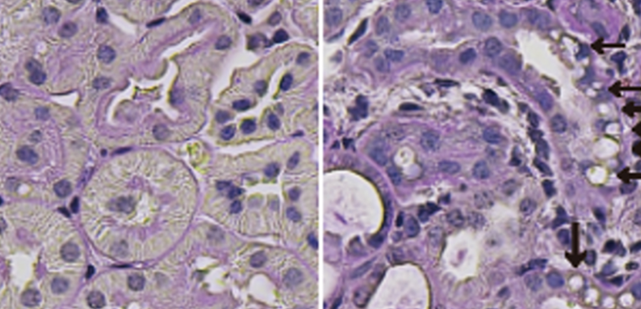 加齢や肥満に伴う腎臓病に対抗する機構を解明