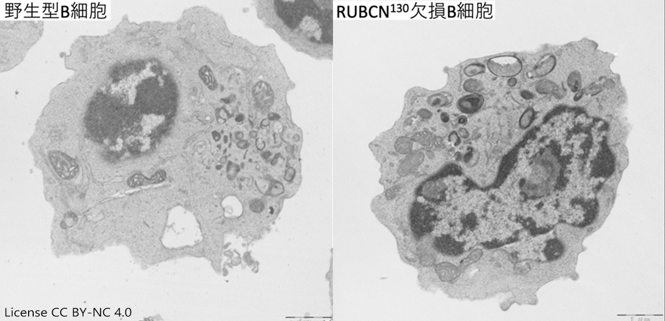 食べるべきか、食べざるべきか： オートファジーを標的にして記憶免疫応答を増強する