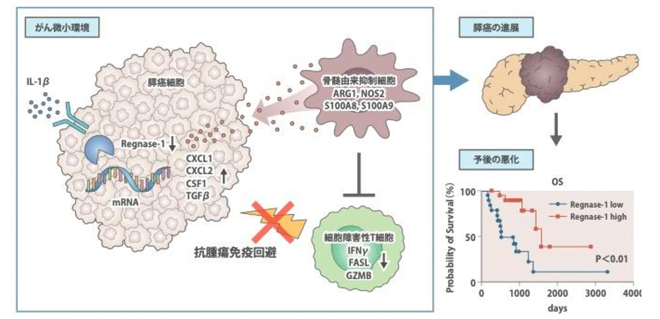 炎症が膵がんを進展する新たなメカニズム - ResOU