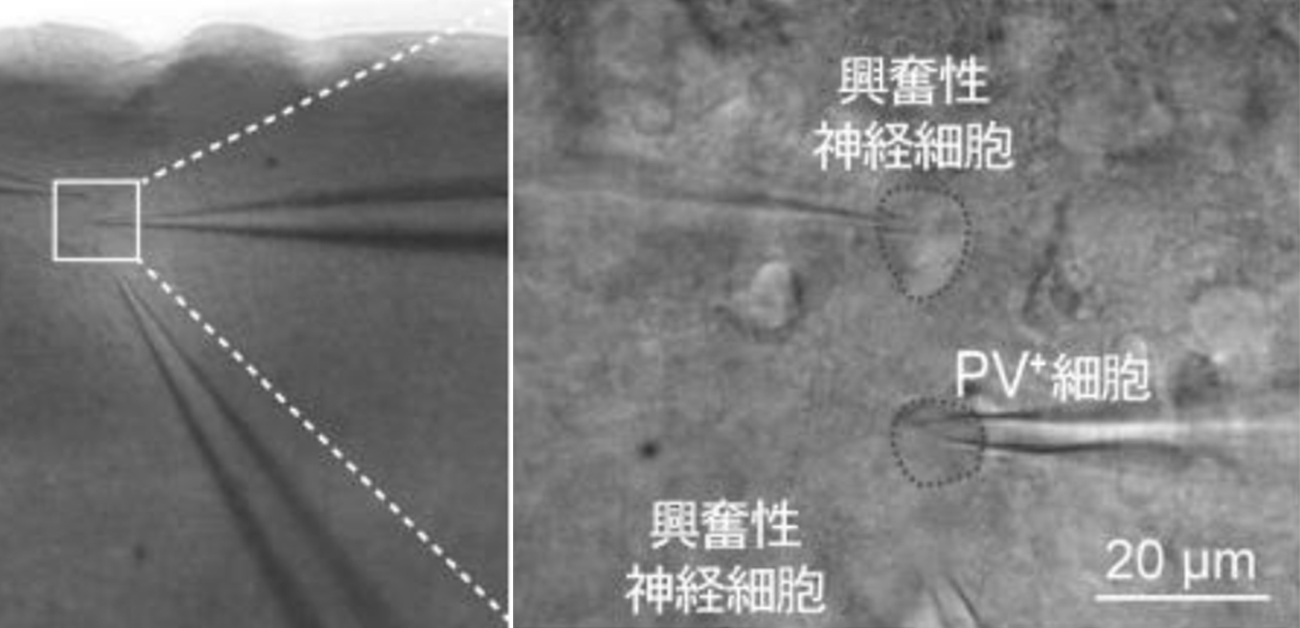 ニューロンの双方向結合を制御する分子メカニズム