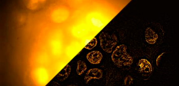 生体内部が見える超解像顕微法を開発