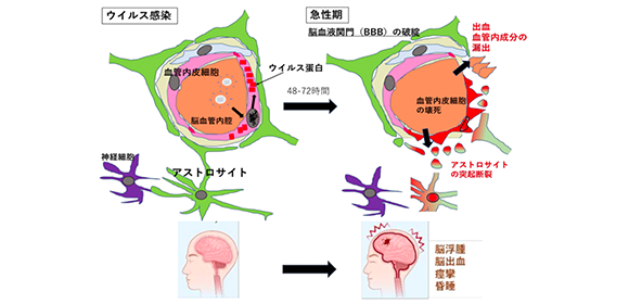 インフルエンザ脳症の発症メカニズムを解明