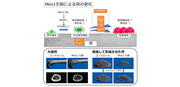 ＼Ca不足やホルモンバランスの変化だけじゃない／ 細胞老化が引き起こす骨粗しょう症