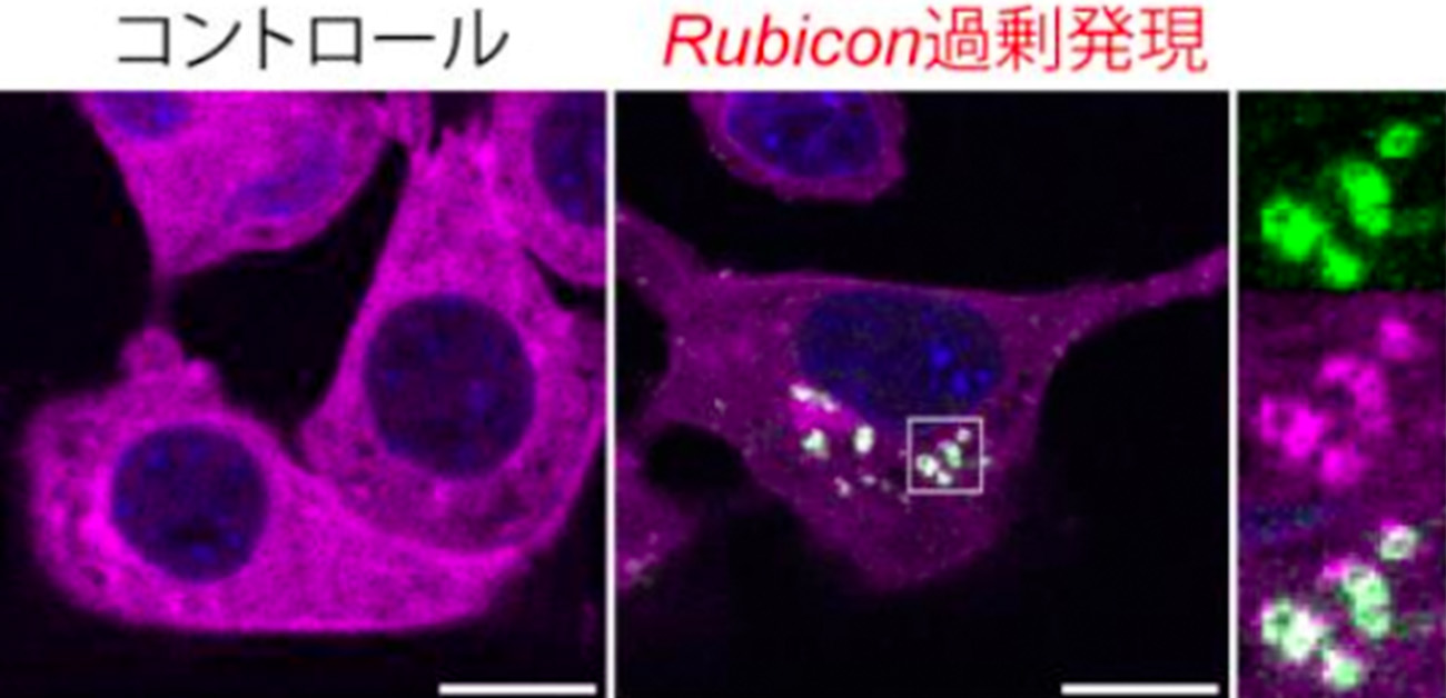 細胞老化を促進するエクソソーム産生メカニズムを解明