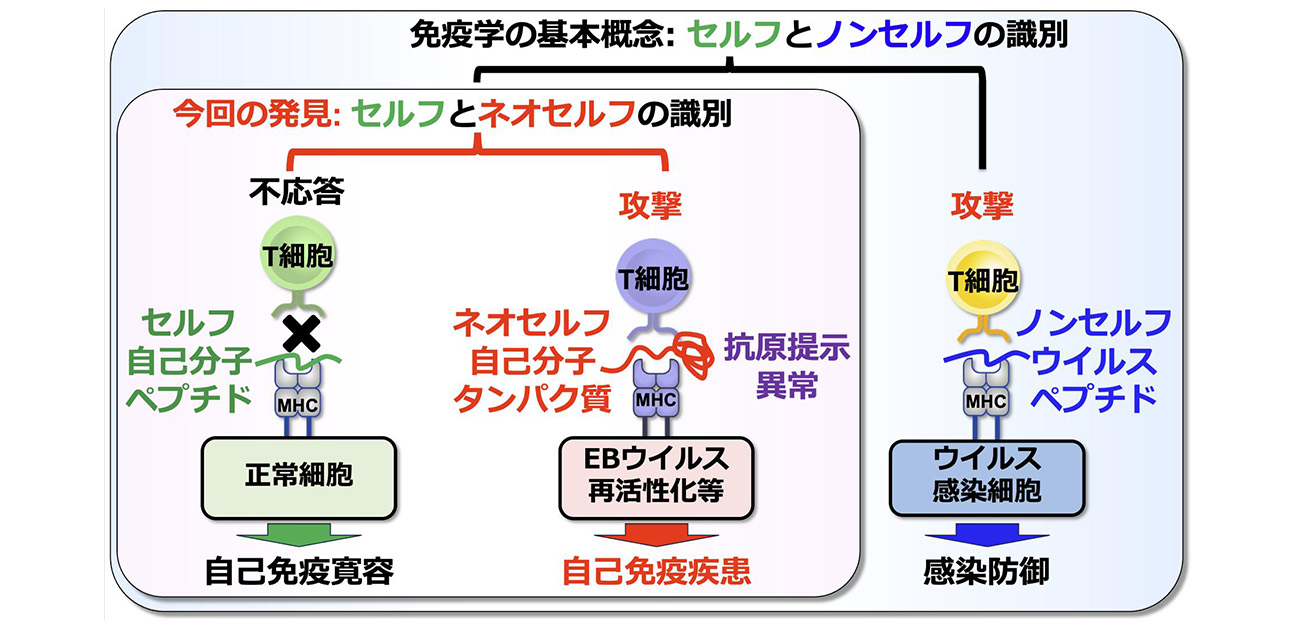 全身性自己免疫疾患の発症機構を解明