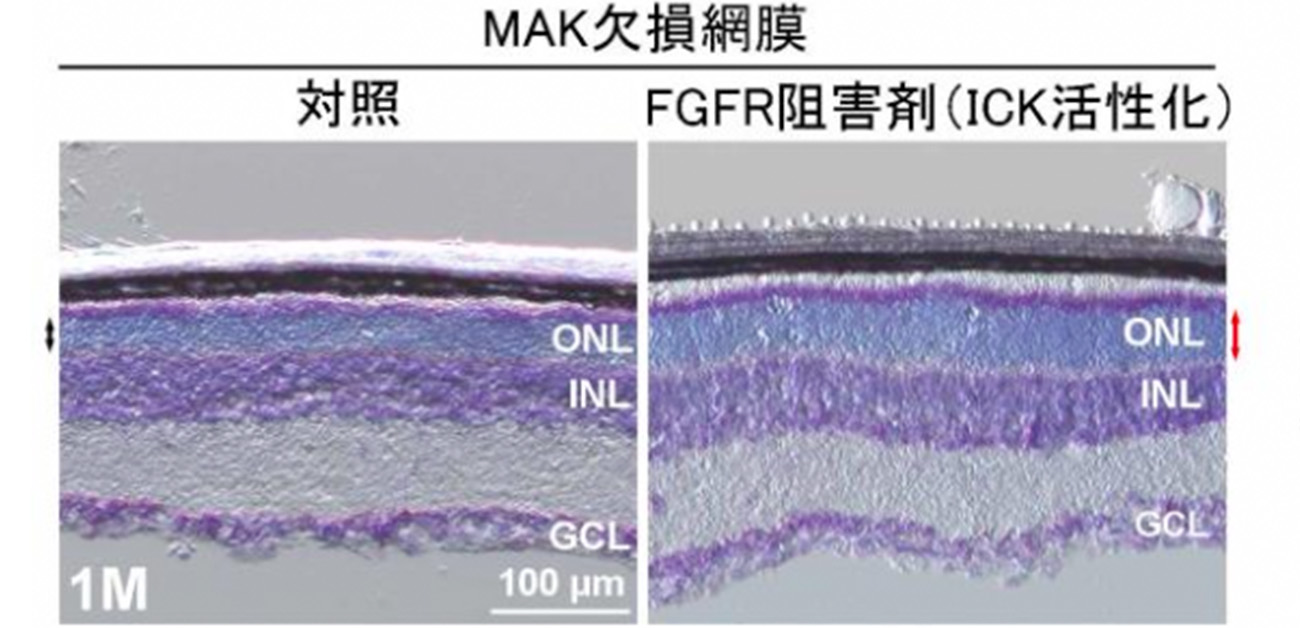 網膜色素変性症をはじめとした 繊毛病（希少難病）の治療法開発に道 - ResOU