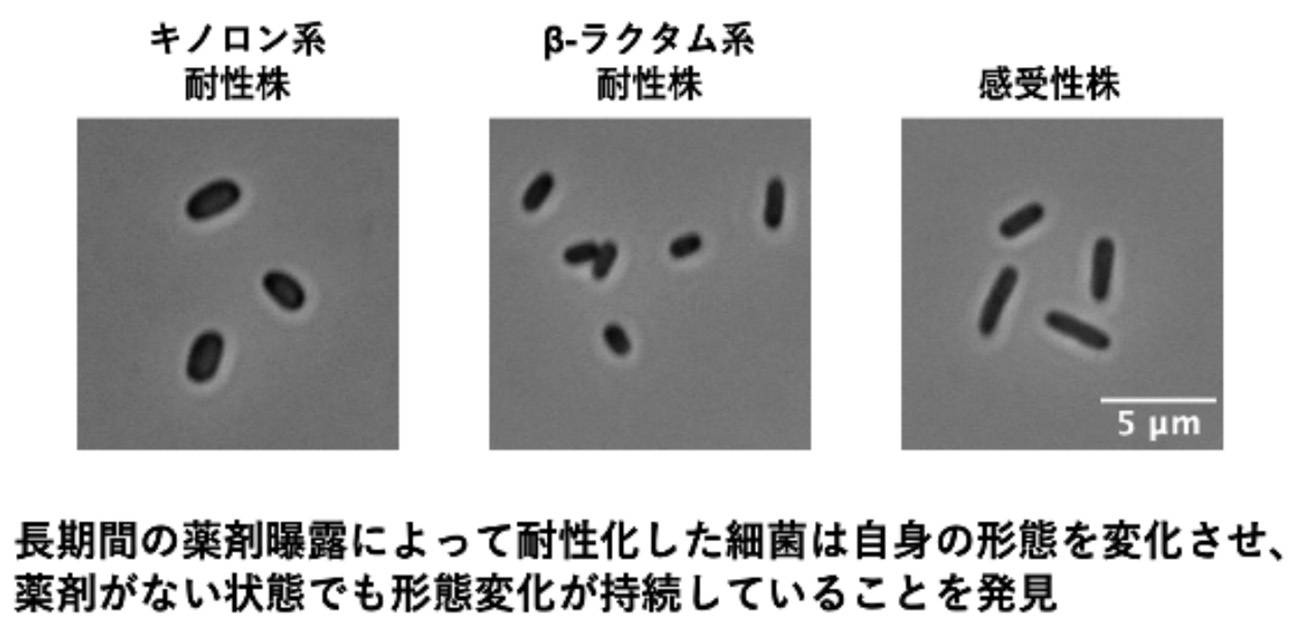 薬に強い菌は「見た目」が違う！ 細菌の形態と薬剤耐性の関連を解明