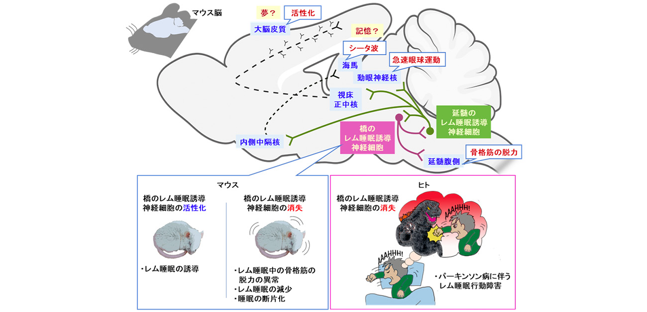 レム睡眠を誘導する神経回路を解明し「夢を演じる病」の原因を特定