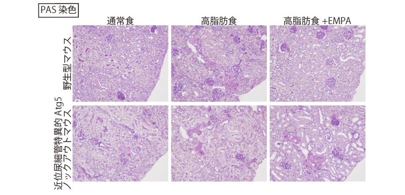 SGLT2阻害薬による腎保護作用の新メカニズムを解明