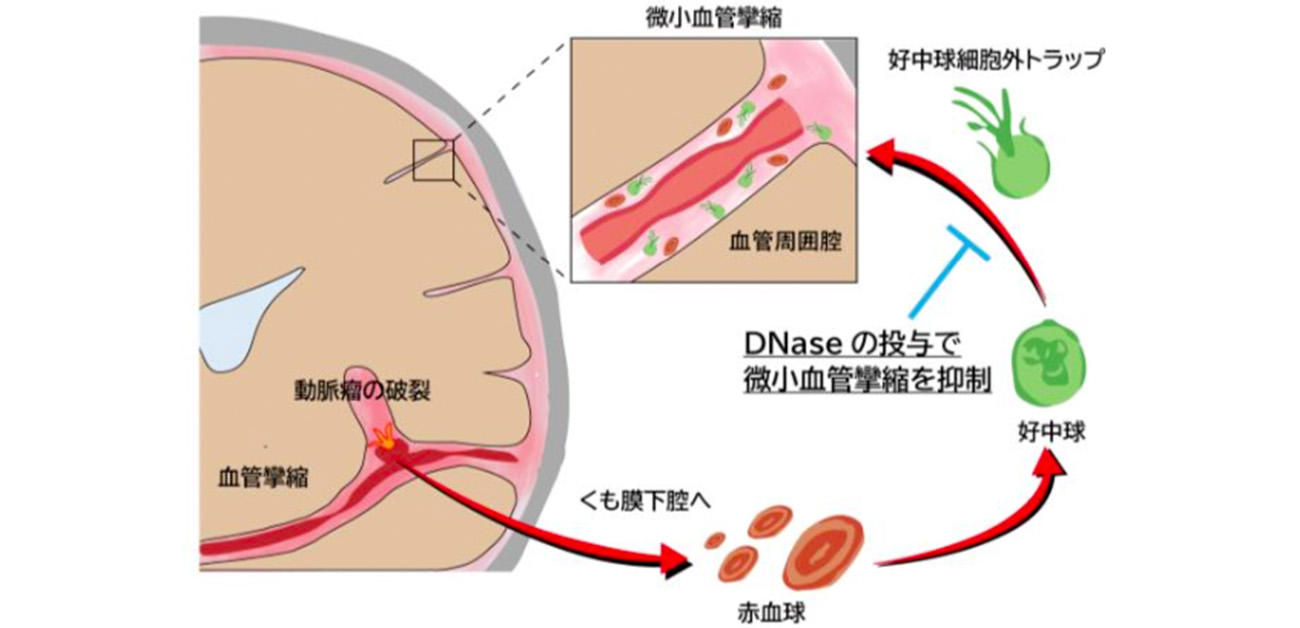 くも膜下出血後に発生する微小血管攣縮のメカニズムを解明