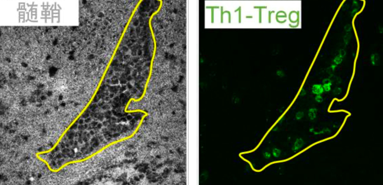 自己免疫性の神経疾患から体を守るTh1-Treg