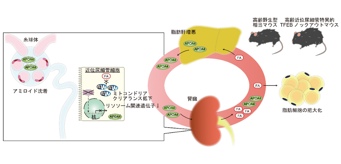 加齢に伴う慢性腎臓病における脂質異常のメカニズムを発見