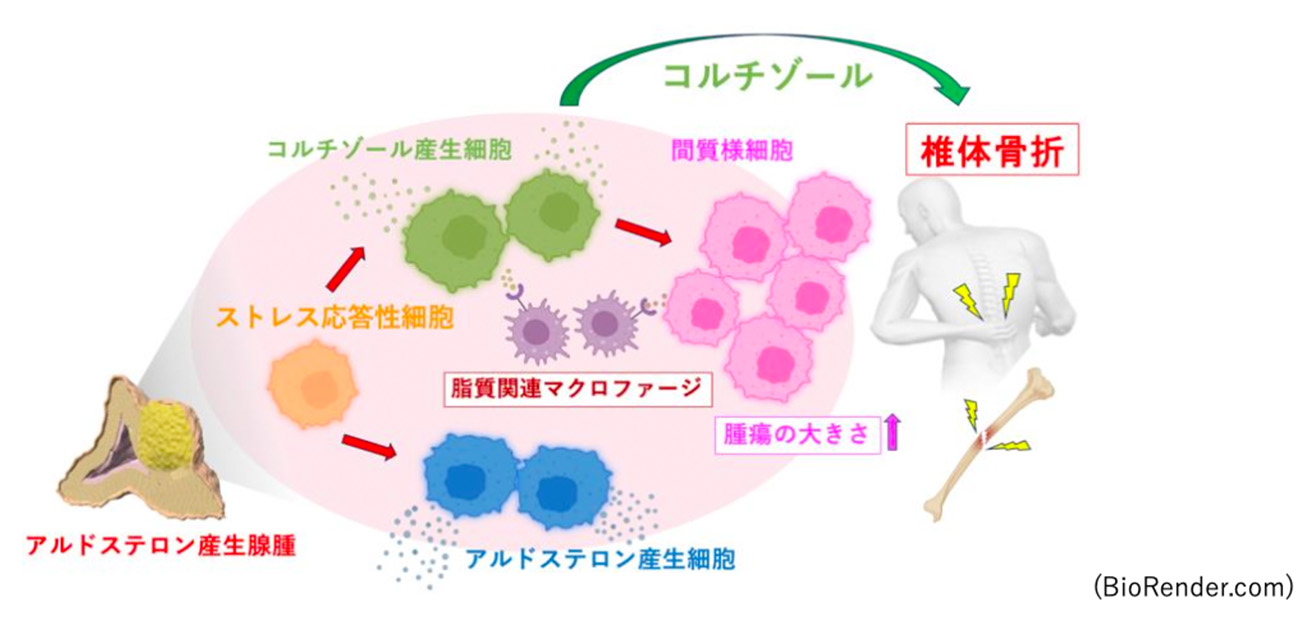 アルドステロン産生腺腫の多様な細胞社会が明らかに