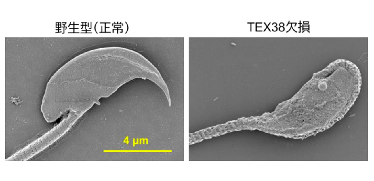 精子の形成に必要なタンパク質複合体を発見