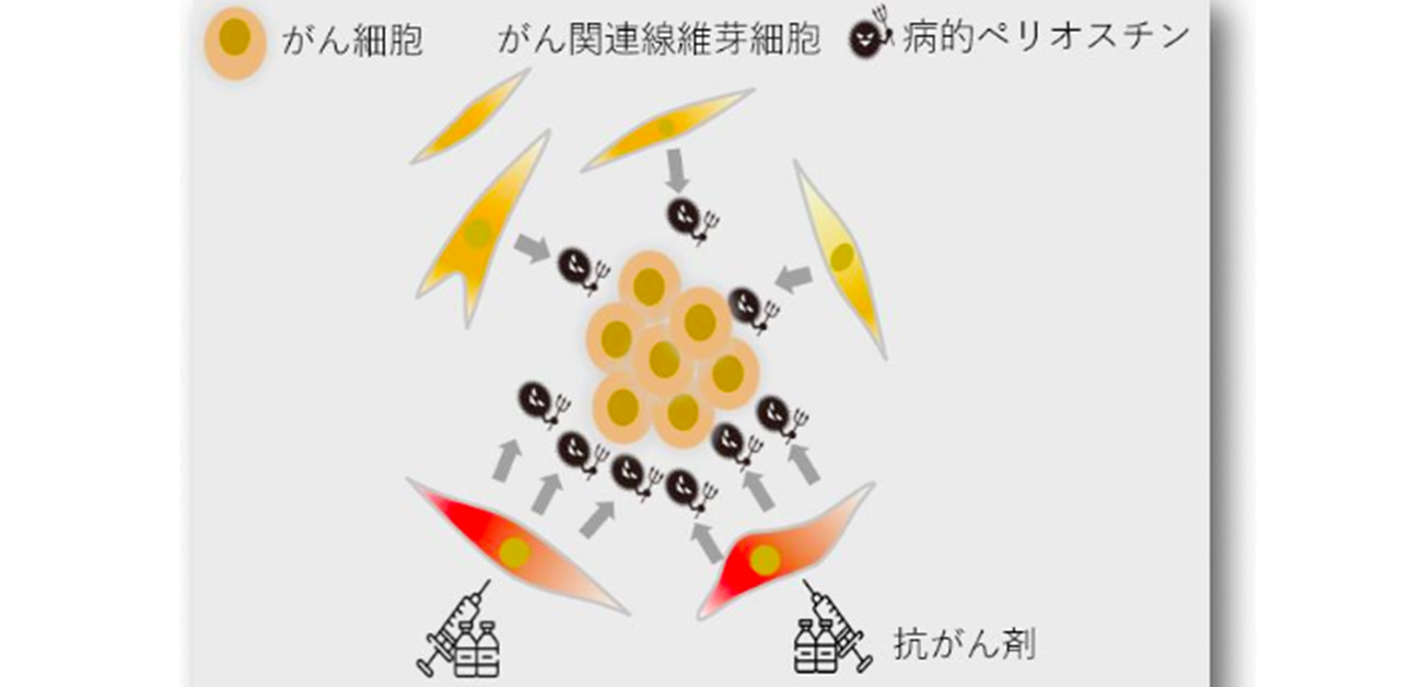 がん治療のブレイクスルーへ！ 転移・再発した乳がんに対する 新規抗体医薬の臨床試験を実施