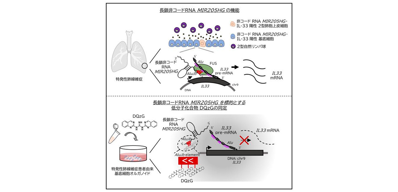 指定難病「特発性肺線維症」で高発現する 長鎖非コードRNAの新たな機能を発見