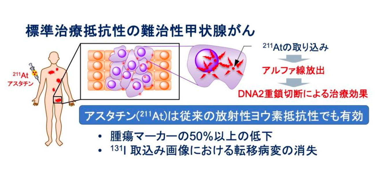 標的α線治療薬アスタチンを用いた 新しいがん治療の安全性・有効性を 