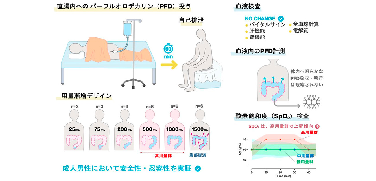 お尻から呼吸する」腸換気法の安全性をヒトで実証 - ResOU