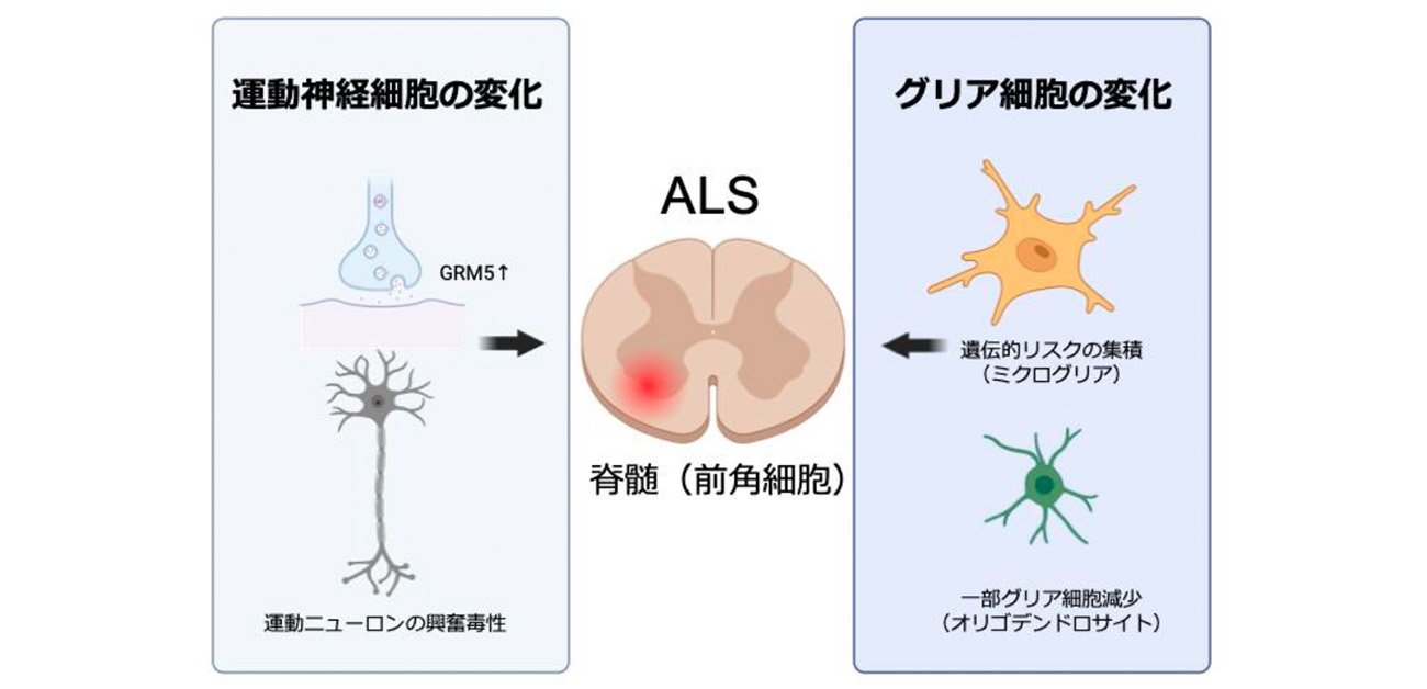 難病ALSの原因に迫る！ - ResOU