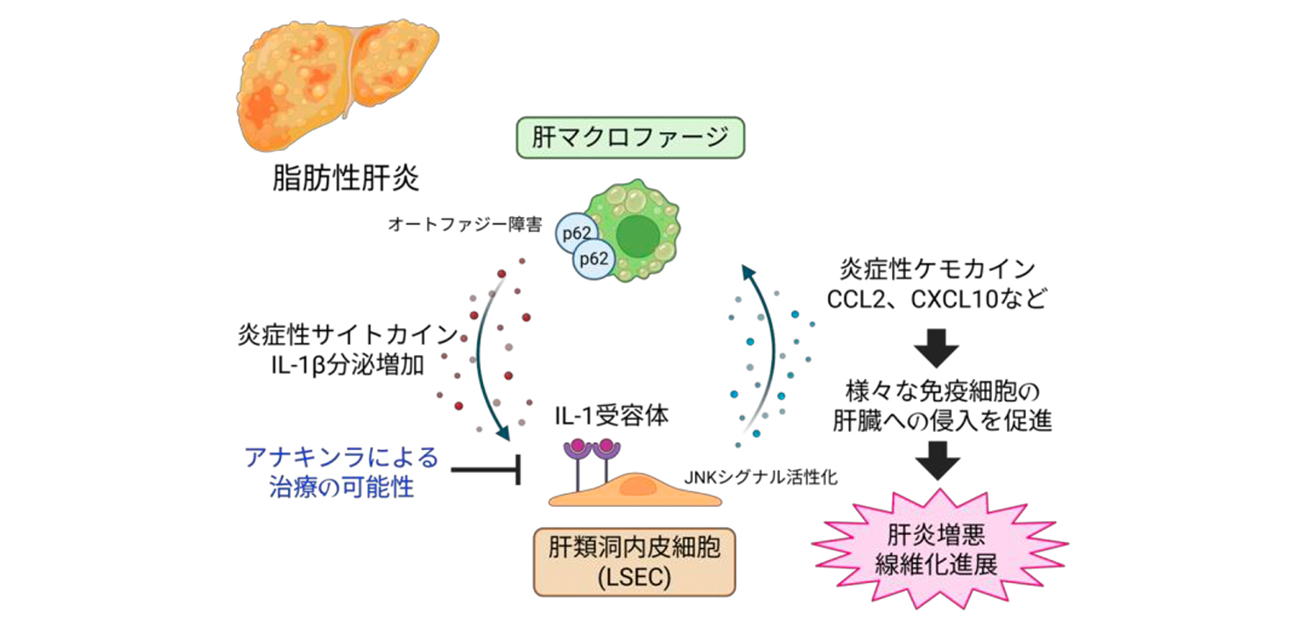 脂肪肝を悪化させる炎症が“広がる仕組み”を解明