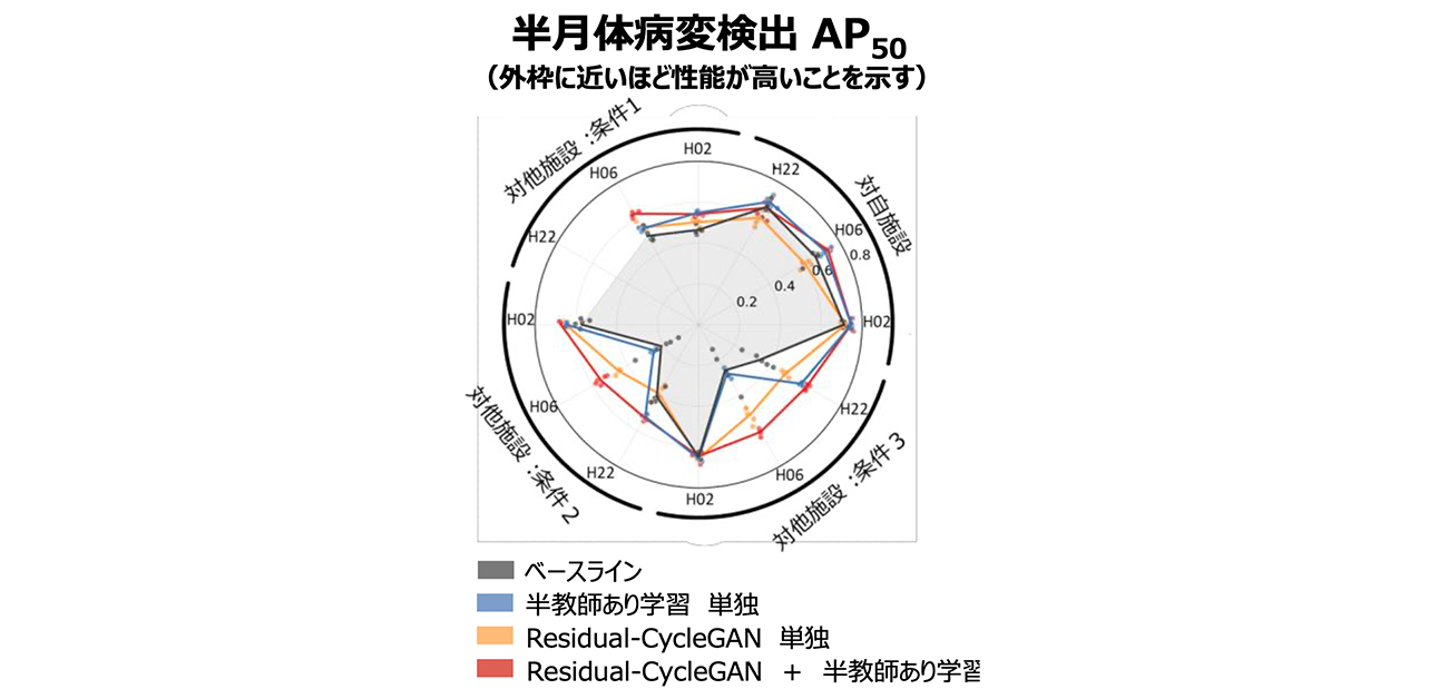 ＼医療格差の解消へ／ 病院の壁を超える腎病理AI診断支援システムを開発