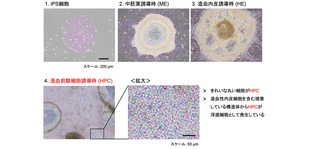 iPS細胞から血液細胞の「タネ」をつくる新基盤を開発