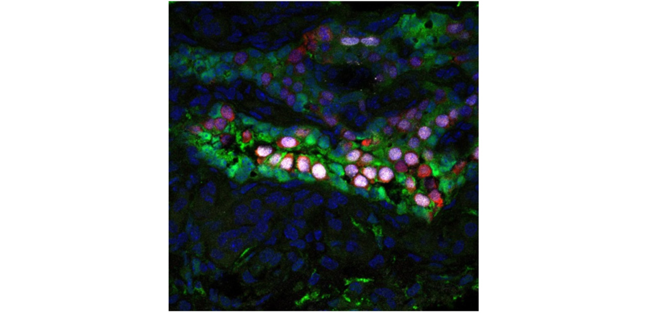 多能性幹細胞から精巣を試験管内で作り出し、精子産生能を持つ精原幹細胞を誘導