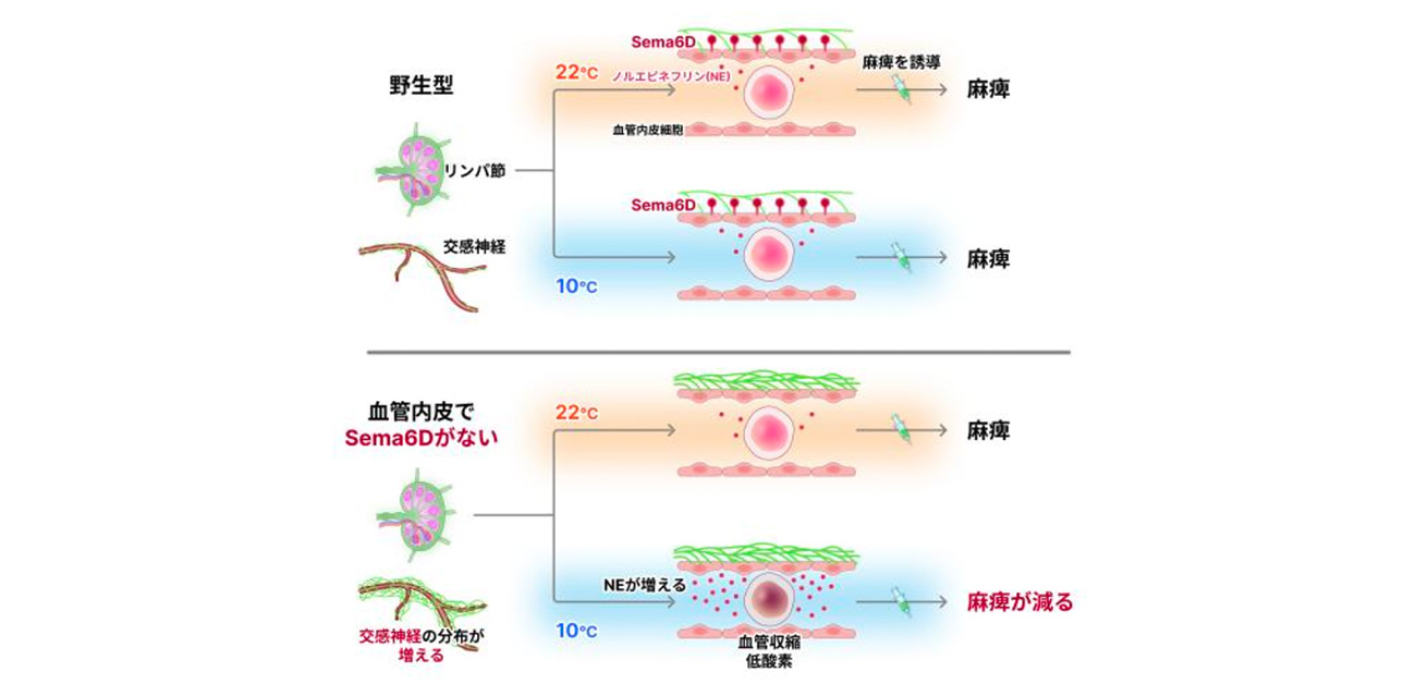 「寒さ」と「病気」をつなぐ新発見