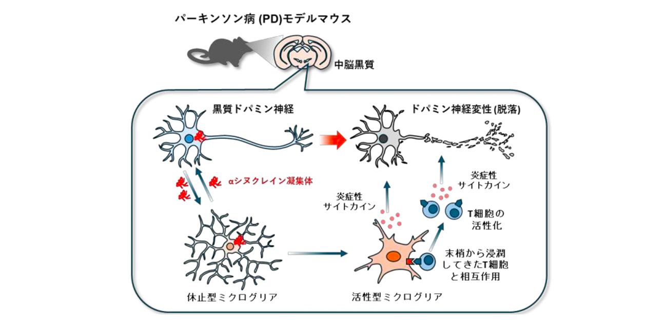 脳の免疫細胞どうしの連携が パーキンソン病様病理を加速する