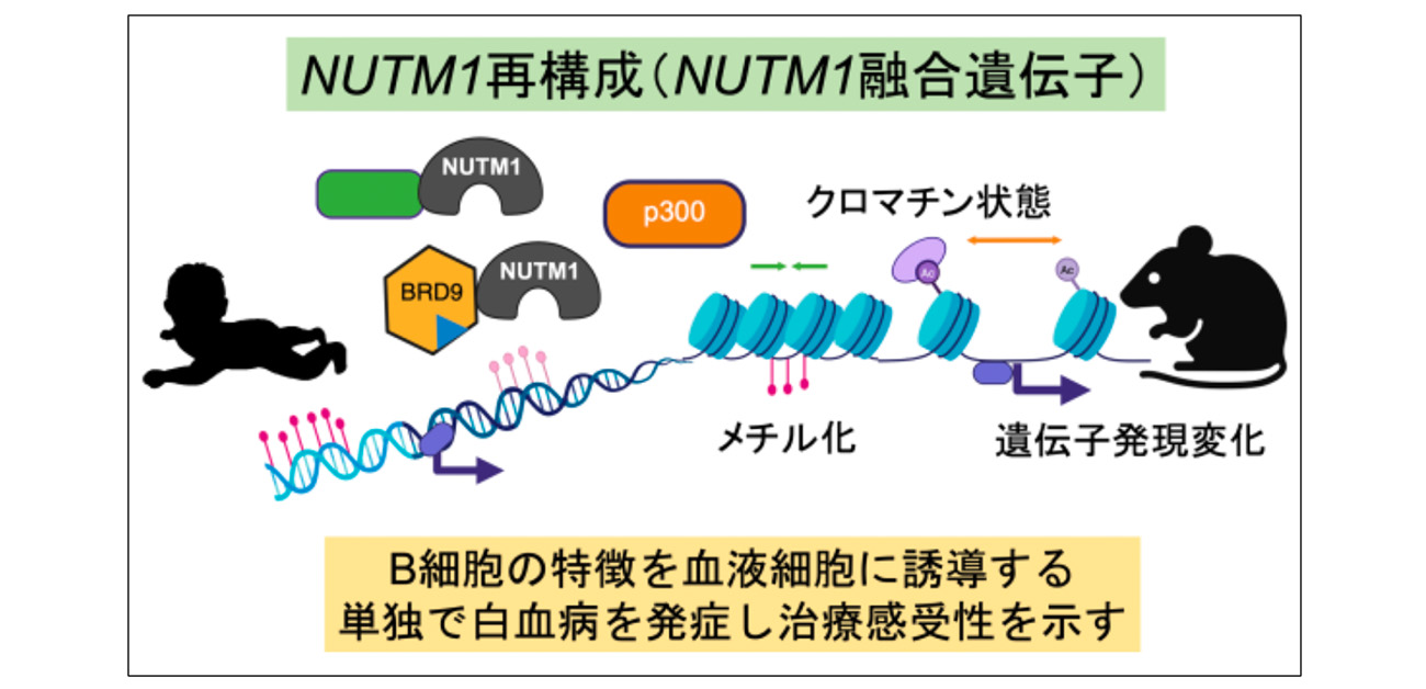NUTM1再構成白血病の包括的理解を実現