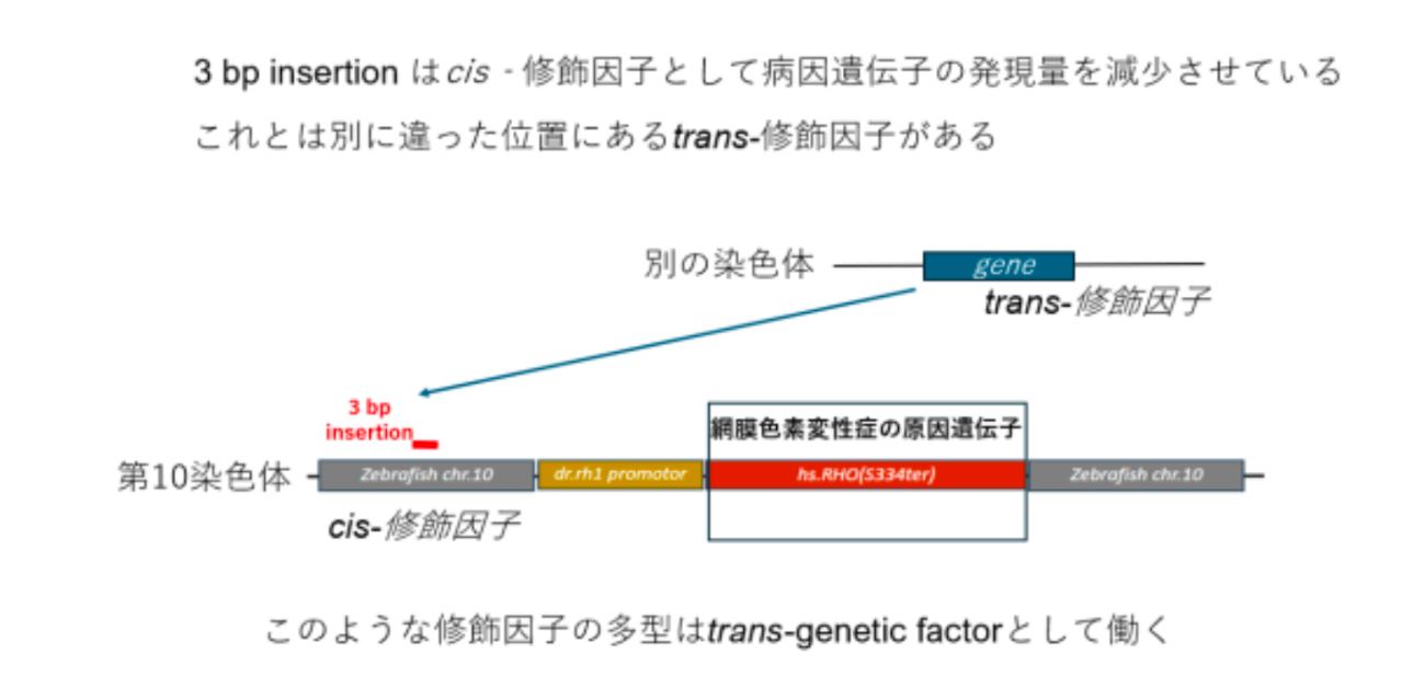 遺伝病の重症さを決める遺伝因子の存在を解明